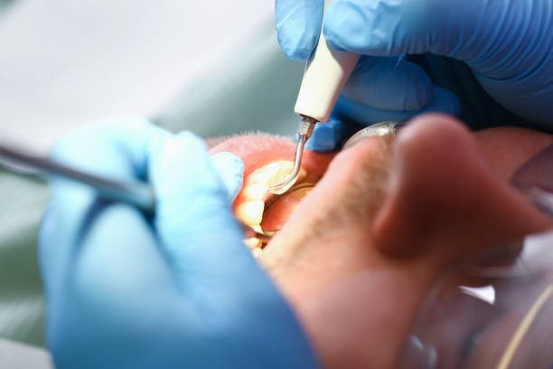Best Emergency Cosmetic Dentistry (e.g., broken veneers) in Wtell, LA